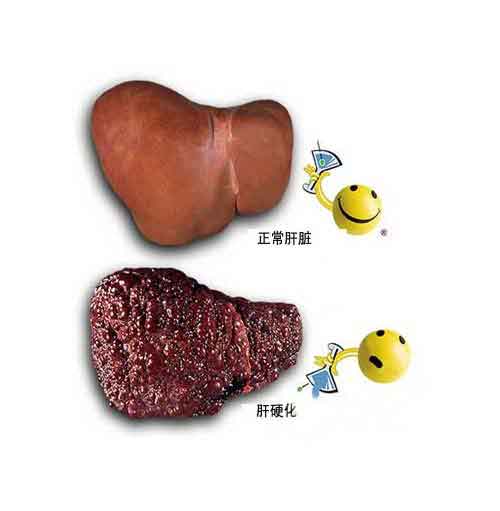 ֣ļҽԺӲ?֣ݺõĸӲרҽԺ